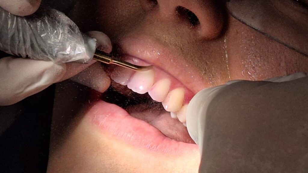 limpeza dentária dentista lago norte