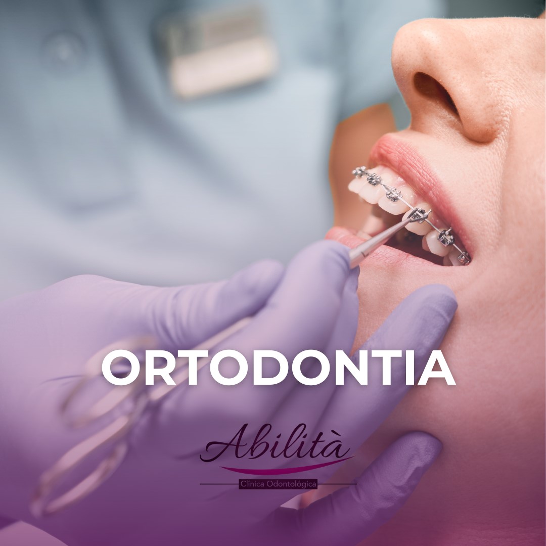 odontologia geral odontopediatra clareamento dental dentista canal alinhadores invisíveis sousmile lente de contato dental tratamento de canal prótese dentária implantes implantes dentário implante dentário ortodontia clínica odontológica consultorio odontológico odontologia clínica de implante dentário endodontia limpeza dos dentes cirurgião dentista extração do siso retirada do siso cirurgia do siso aparelho ortodontico odontopediatra em brasília odontopediatra distrito federal odontopediatra df odontopediatra lago norte clareamento dental clareamento dental em brasília clareamento dental lago norte clareamento dental df clareamento dentral distrito federal clareamento dos dentes dentista clareamento dentista em brasília dentista lago norte dentista distrito federal dentista df cliníca de tratamento de canal em brasília cliníca de tratamento de canal lago norte cliníca de tratamento de canal df cliníca de tratamento de canal distrito federal cliníca de prótese dentária em brasília cliníca de prótese dentária lago norte cliníca de prótese dentária df cliníca de prótese dentária distrito federal implantes dentário em brasília implantes dentário lago norte implantes dentário df implantes dentário distrito federal clínica de implante dentário em brasília clínica de implante dentário df clínica de implante dentário distrito federal clínica odontológica em brasília clínica odontológica lago norte clínica odontológica df clínica odontológica distrito federal cirurgião dentista brasília cirurgião dentista lago norte cirurgião dentista df cirurgião dentista distrito federal endodontia lago norte endodontia brasília endodontia df endodontia distrito federal ortodontia brasília ortodontia lago norte ortodontia distrito federal ortodontia df prótese dentária brasília prótese dentária lago norte prótese dentária df prótese dentária distrito federal aparelho ortodontico brasília aparelho ortodontico lago norte aparelho ortodontico df aparelho ortodontico df alinhadores invisiveis aparelho invisivel