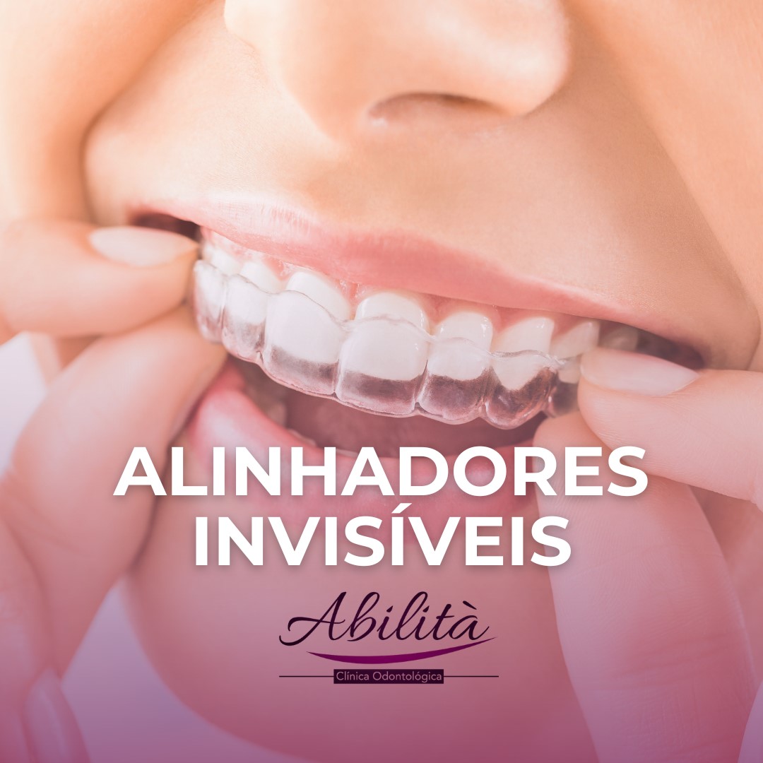 odontologia geral odontopediatra clareamento dental dentista canal alinhadores invisíveis sousmile lente de contato dental tratamento de canal prótese dentária implantes implantes dentário implante dentário ortodontia clínica odontológica consultorio odontológico odontologia clínica de implante dentário endodontia limpeza dos dentes cirurgião dentista extração do siso retirada do siso cirurgia do siso aparelho ortodontico odontopediatra em brasília odontopediatra distrito federal odontopediatra df odontopediatra lago norte clareamento dental clareamento dental em brasília clareamento dental lago norte clareamento dental df clareamento dentral distrito federal clareamento dos dentes dentista clareamento dentista em brasília dentista lago norte dentista distrito federal dentista df cliníca de tratamento de canal em brasília cliníca de tratamento de canal lago norte cliníca de tratamento de canal df cliníca de tratamento de canal distrito federal cliníca de prótese dentária em brasília cliníca de prótese dentária lago norte cliníca de prótese dentária df cliníca de prótese dentária distrito federal implantes dentário em brasília implantes dentário lago norte implantes dentário df implantes dentário distrito federal clínica de implante dentário em brasília clínica de implante dentário df clínica de implante dentário distrito federal clínica odontológica em brasília clínica odontológica lago norte clínica odontológica df clínica odontológica distrito federal cirurgião dentista brasília cirurgião dentista lago norte cirurgião dentista df cirurgião dentista distrito federal endodontia lago norte endodontia brasília endodontia df endodontia distrito federal ortodontia brasília ortodontia lago norte ortodontia distrito federal ortodontia df prótese dentária brasília prótese dentária lago norte prótese dentária df prótese dentária distrito federal aparelho ortodontico brasília aparelho ortodontico lago norte aparelho ortodontico df aparelho ortodontico dfnorte clareamento dental clareamento dental em brasília clareamento dental lago norte clareamento dental df clareamento dentral distrito federal clareamento dos dentes dentista clareamento dentista em brasília dentista lago norte dentista distrito federal dentista df cliníca de tratamento de canal em brasília cliníca de tratamento de canal lago norte cliníca de tratamento de canal df cliníca de tratamento de canal distrito federal cliníca de prótese dentária em brasília cliníca de prótese dentária lago norte cliníca de prótese dentária df cliníca de prótese dentária distrito federal implantes dentário em brasília implantes dentário lago norte implantes dentário df implantes dentário distrito federal clínica de implante dentário em brasília clínica de implante dentário df clínica de implante dentário distrito federal clínica odontológica em brasília clínica odontológica lago norte clínica odontológica df clínica odontológica distrito federal cirurgião dentista brasília cirurgião dentista lago norte cirurgião dentista df cirurgião dentista distrito federal endodontia lago norte endodontia brasília endodontia df endodontia distrito federal ortodontia brasília ortodontia lago norte ortodontia distrito federal ortodontia df prótese dentária brasília prótese dentária lago norte prótese dentária df prótese dentária distrito federal aparelho ortodontico brasília aparelho ortodontico lago norte aparelho ortodontico df aparelho ortodontico di