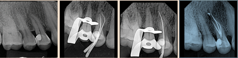 endodontista brasília; endodontista lago norte; endodontista