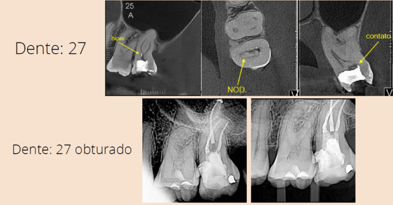 endodontista brasília; endodontista lago norte; endodontista