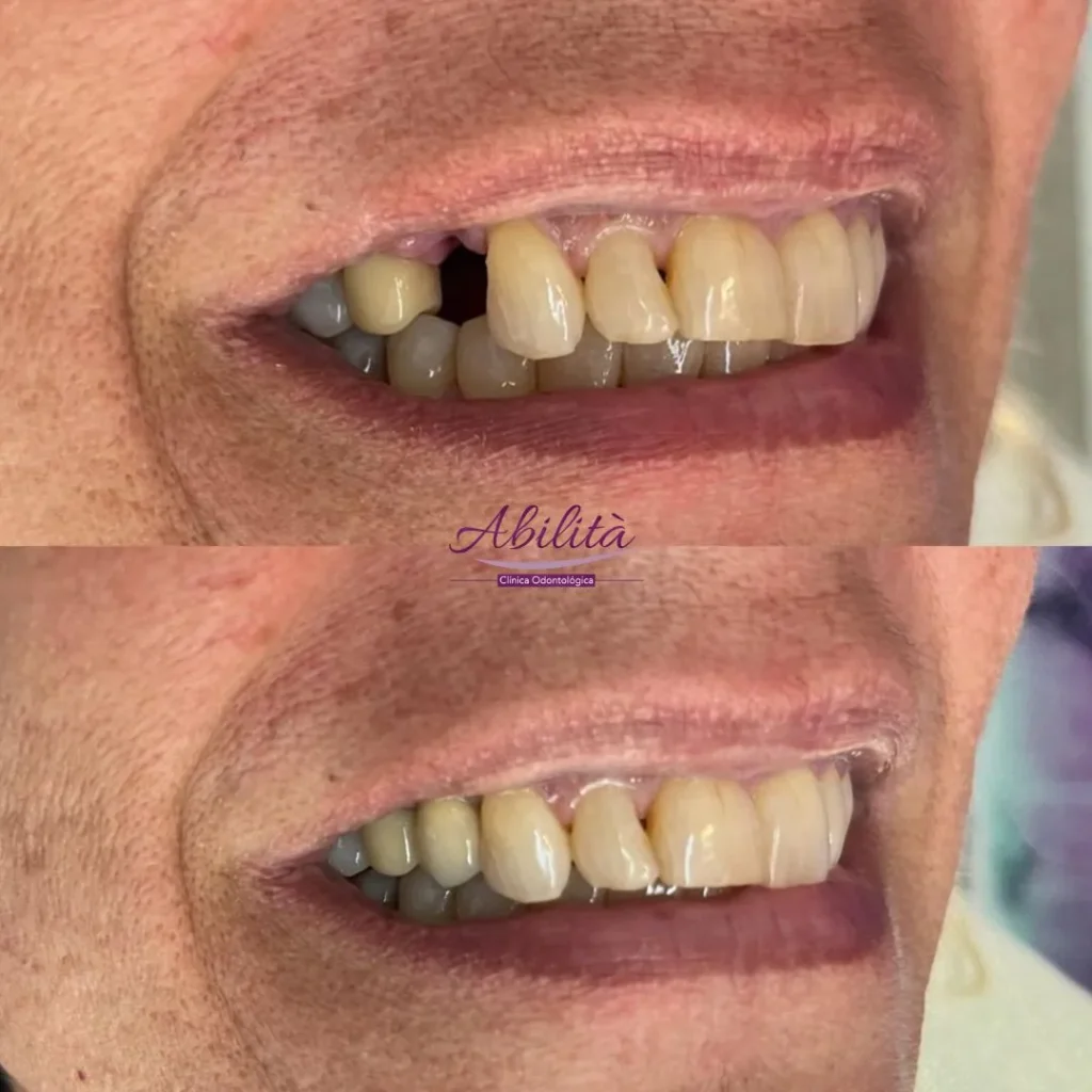 Abilita Odontologia - Dentista no Lago Norte - Brasilía