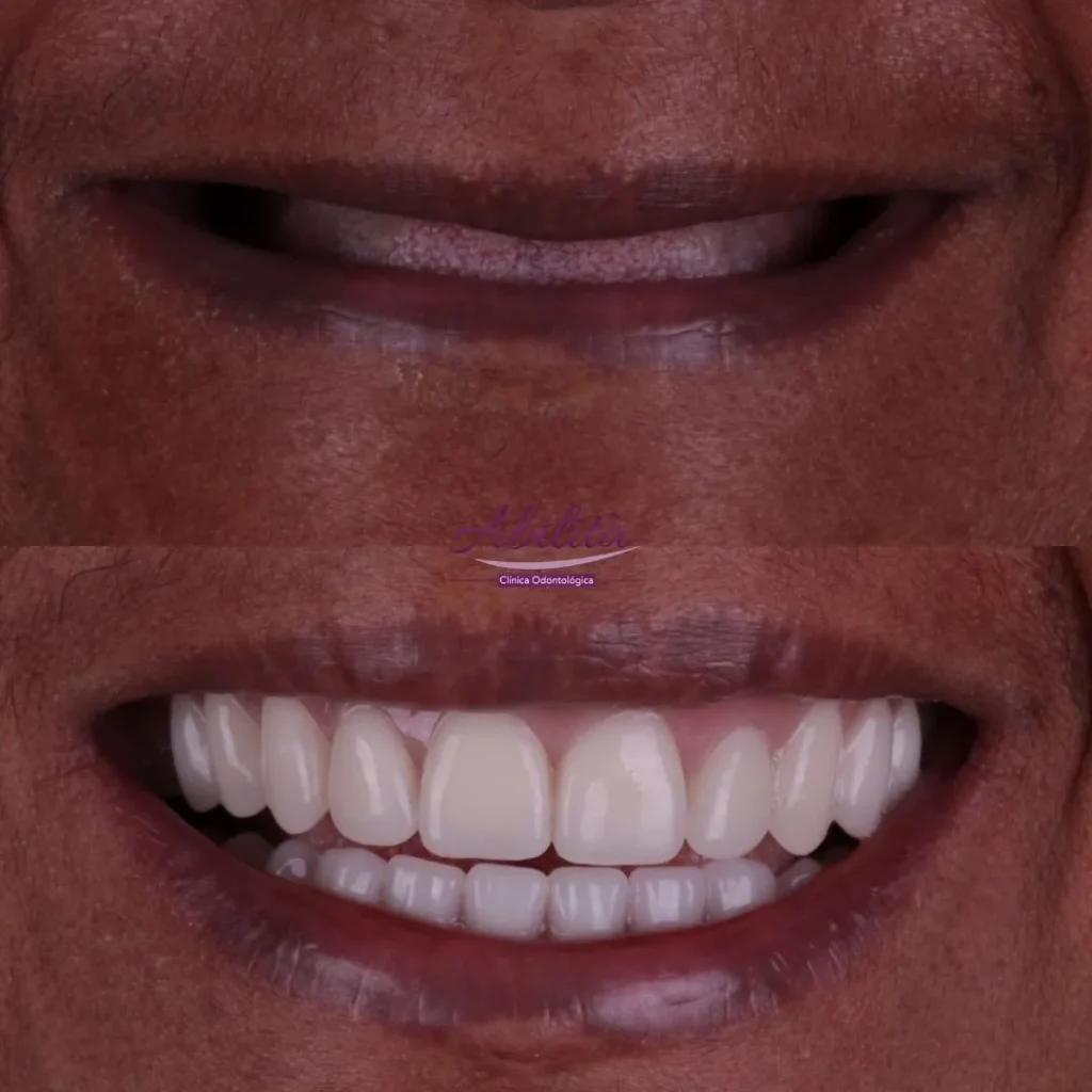 Abilita Odontologia - Dentista no Lago Norte - Brasilía