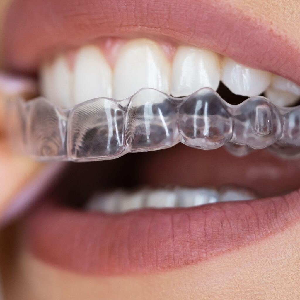 Abilita Odontologia - Dentista no Lago Norte - Brasilía