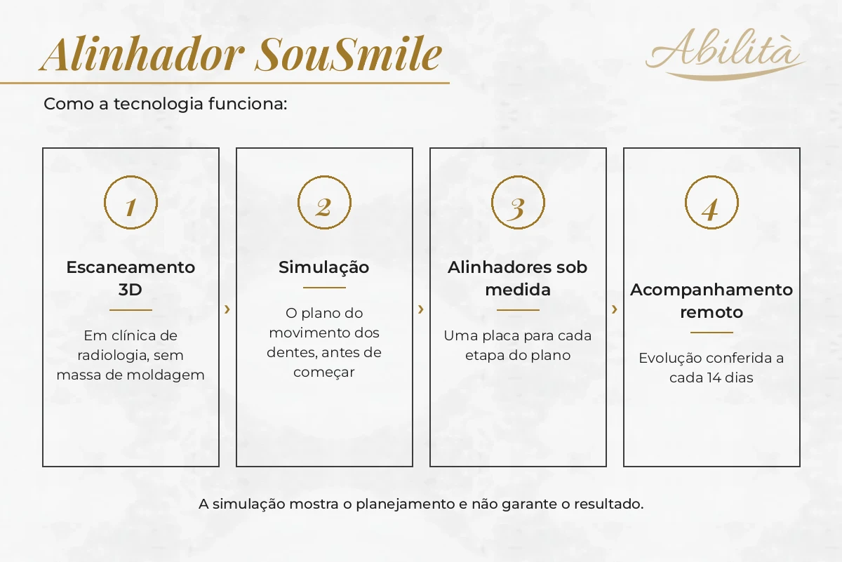 Alinhadores invisíveis planejados de forma digital — Abilità, Lago Norte, Brasília