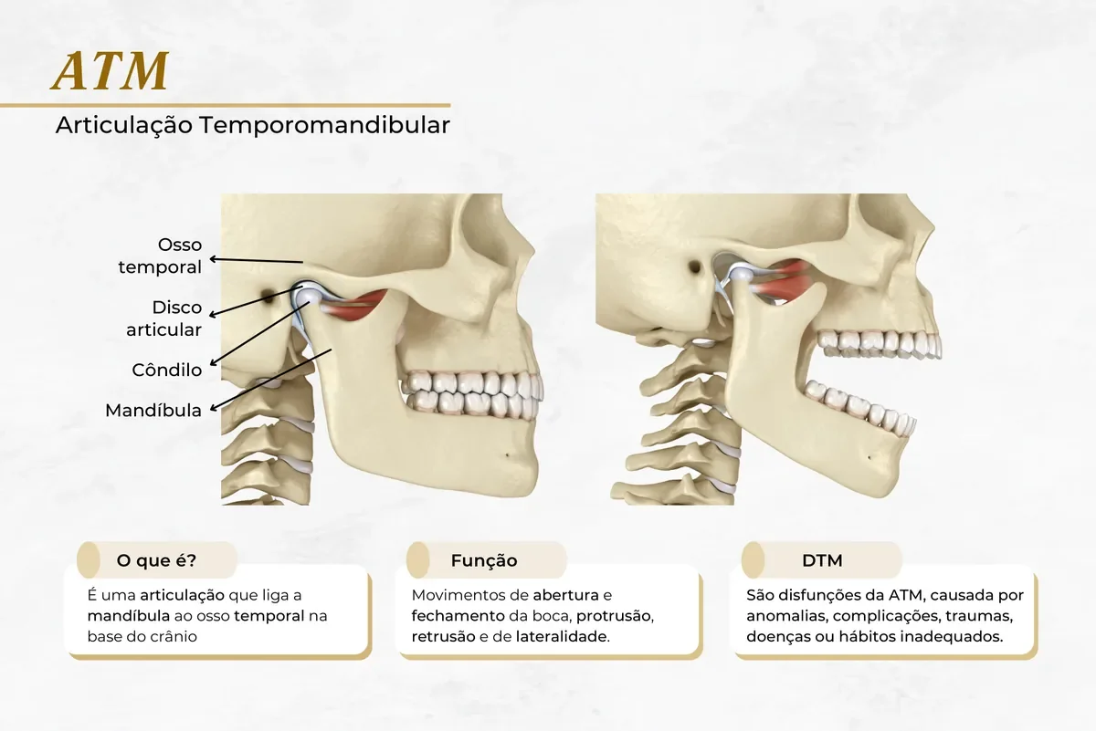 DTM e disfunção da ATM: dor na mandíbula tem solução