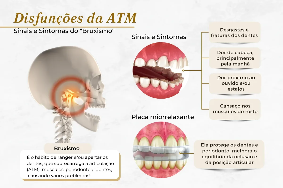 Placa miorrelaxante: para que serve, como usar e quanto custa