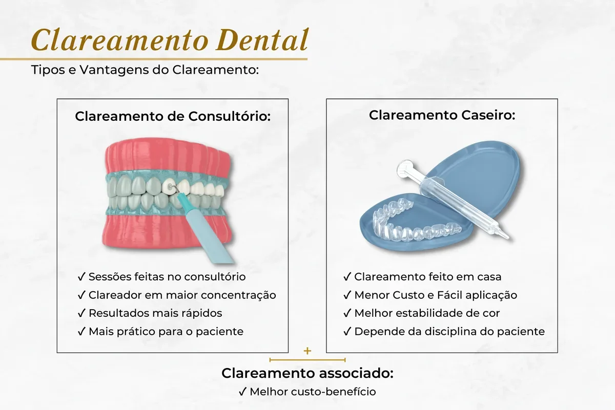 Tipos e vantagens do clareamento dental — Abilità, Lago Norte, Brasília