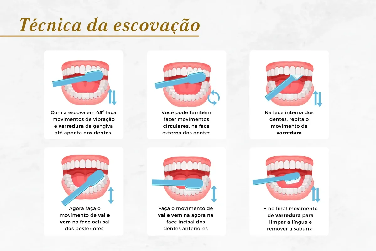 Limpeza dental profissional e cuidado diário — Abilità, Lago Norte, Brasília