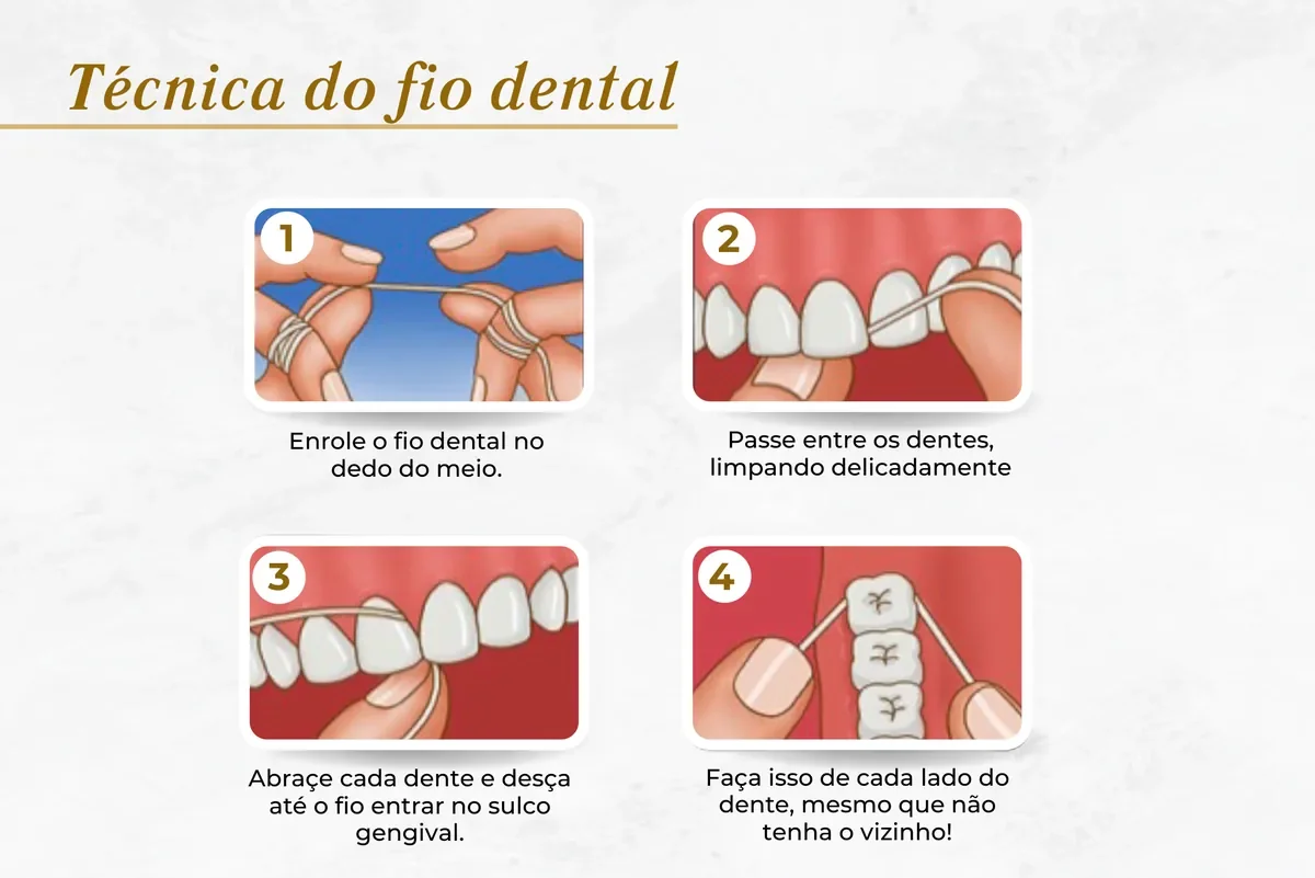 Técnica do fio dental — Abilità, Brasília