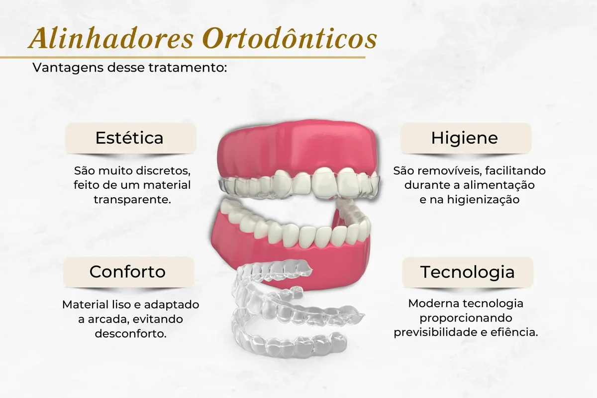 SouSmile em Brasília: o que é, como funciona e quando indicar