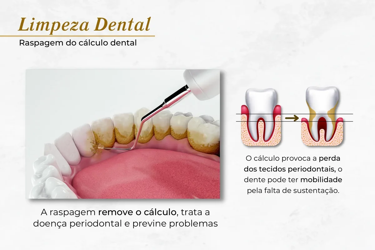 Raspagem periodontal em Brasília: o que é, como é feita e o que esperar